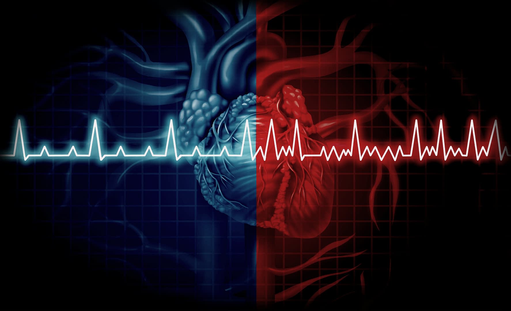 Illustration showing a heart divided into two halves with contrasting colors and an ECG waveform overlay. - Olive Oil Times
