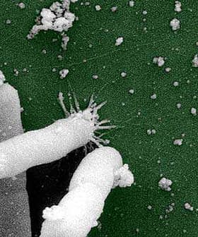 Microscopic view of rod-shaped bacteria with spiky structures on a green background. - Olive Oil Times