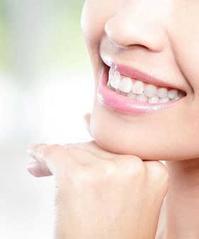 Close-up of a woman's face showing a smile with white teeth and clear skin. - Olive Oil Times