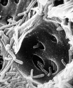 Black and white scanning electron microscope image showing bacteria on a surface. - Olive Oil Times