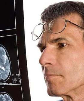 A man wearing glasses closely examining a brain scan displayed on an X-ray film. - Olive Oil Times