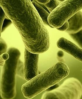 Microscopic view of green bacteria with various shapes and sizes floating in a green background. - Olive Oil Times