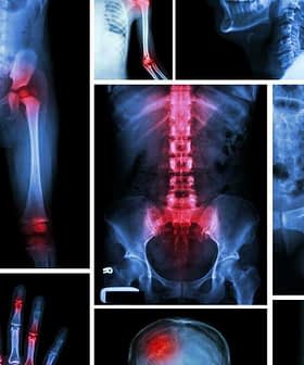 Collage featuring various medical X-ray images of bones and joints in different positions and conditions. - Olive Oil Times