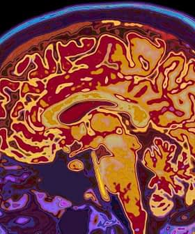 Colorful MRI scan image showing the internal structure of a human brain. - Olive Oil Times