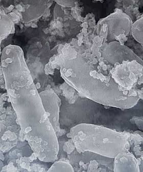 Microscopic view of Lactobacillus pentosus bacteria with a textured surface and irregular shapes. - Olive Oil Times