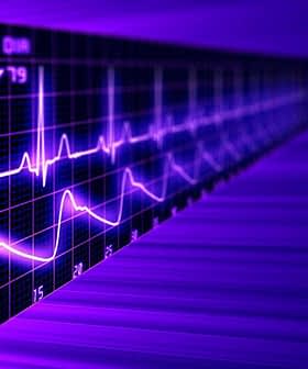 Electrocardiogram display showing a heart rate of 60 beats per minute in purple tones. - Olive Oil Times