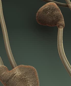 Immagine microscopica che mostra gli spermatozoi con forme e strutture distinte su uno sfondo scuro. - Olive Oil Times