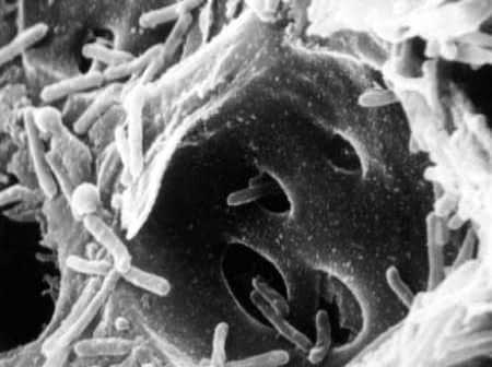 Image en noir et blanc prise au microscope électronique à balayage montrant des bactéries sur une surface. - Olive Oil Times