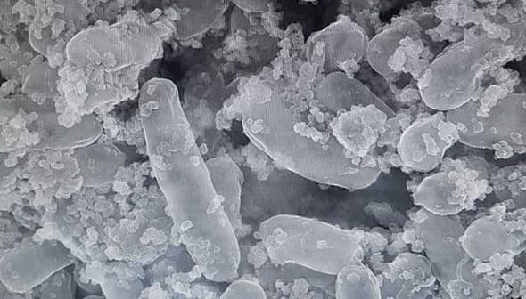 Microscopic view of Lactobacillus pentosus bacteria with a textured surface and irregular shapes. - Olive Oil Times