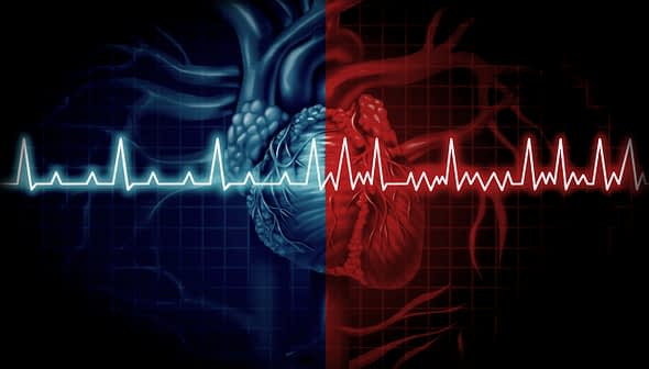 Illustration showing a heart divided into two halves with contrasting colors and an ECG waveform overlay. - Olive Oil Times