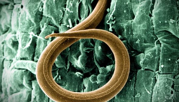 Microscopic view of a nematode exhibiting a distinct coiled shape against a textured background. - Olive Oil Times