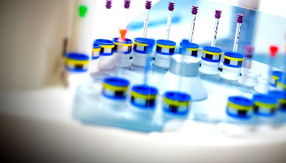 A collection of laboratory sample tubes with colored caps arranged in a circular holder. - Olive Oil Times