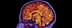Colorful MRI scan image showing the internal structure of a human brain. - Olive Oil Times