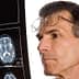 A man wearing glasses closely examining a brain scan displayed on an X-ray film. - Olive Oil Times