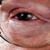 Close-up view of an elderly person's eye wearing glasses, showing fine details of the skin and eye. - Olive Oil Times