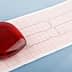 A red heart-shaped object placed on an electrocardiogram (ECG) paper showing heart activity. - Olive Oil Times