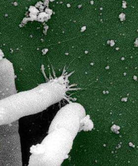 Microscopic view of rod-shaped bacteria with spiky structures on a green background. - Olive Oil Times