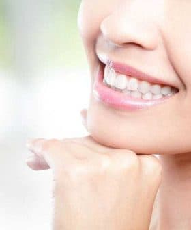 Close-up of a woman's face showing a smile with white teeth and clear skin. - Olive Oil Times