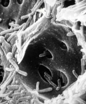 Black and white scanning electron microscope image showing bacteria on a surface. - Olive Oil Times