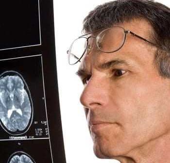 A man wearing glasses closely examining a brain scan displayed on an X-ray film. - Olive Oil Times