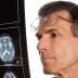 A man wearing glasses closely examining a brain scan displayed on an X-ray film. - Olive Oil Times