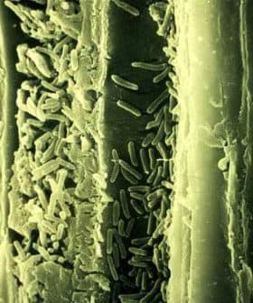 Microscopic view showing various bacteria on a textured surface under magnification. - Olive Oil Times