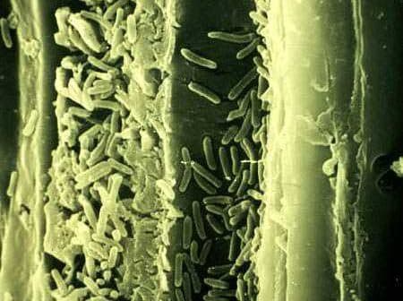 Microscopic view showing various bacteria on a textured surface under magnification. - Olive Oil Times