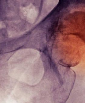 Medical imaging showing the hip joint with highlighted areas indicating potential issues. - Olive Oil Times