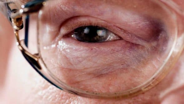 Close-up view of an elderly person's eye wearing glasses, showing fine details of the skin and eye. - Olive Oil Times
