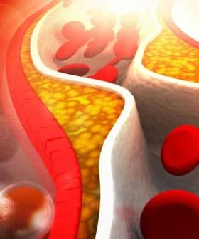 Illustration depicting blood vessels with red blood cells and cholesterol buildup inside. - Olive Oil Times