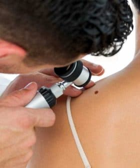 A doctor examining a patient's back with a dermatoscope to assess a skin lesion. - Olive Oil Times