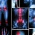 Collage featuring various medical X-ray images of bones and joints in different positions and conditions. - Olive Oil Times