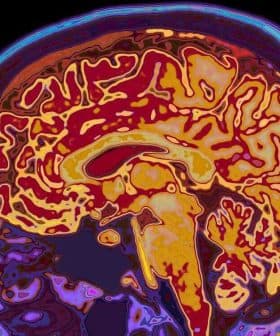 Colorful MRI scan image showing the internal structure of a human brain. - Olive Oil Times