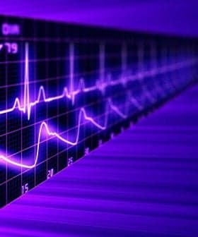 Electrocardiogram display showing a heart rate of 60 beats per minute in purple tones. - Olive Oil Times