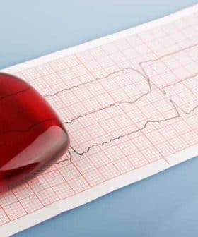 A red heart-shaped object placed on an electrocardiogram (ECG) paper showing heart activity. - Olive Oil Times