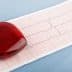 A red heart-shaped object placed on an electrocardiogram (ECG) paper showing heart activity. - Olive Oil Times