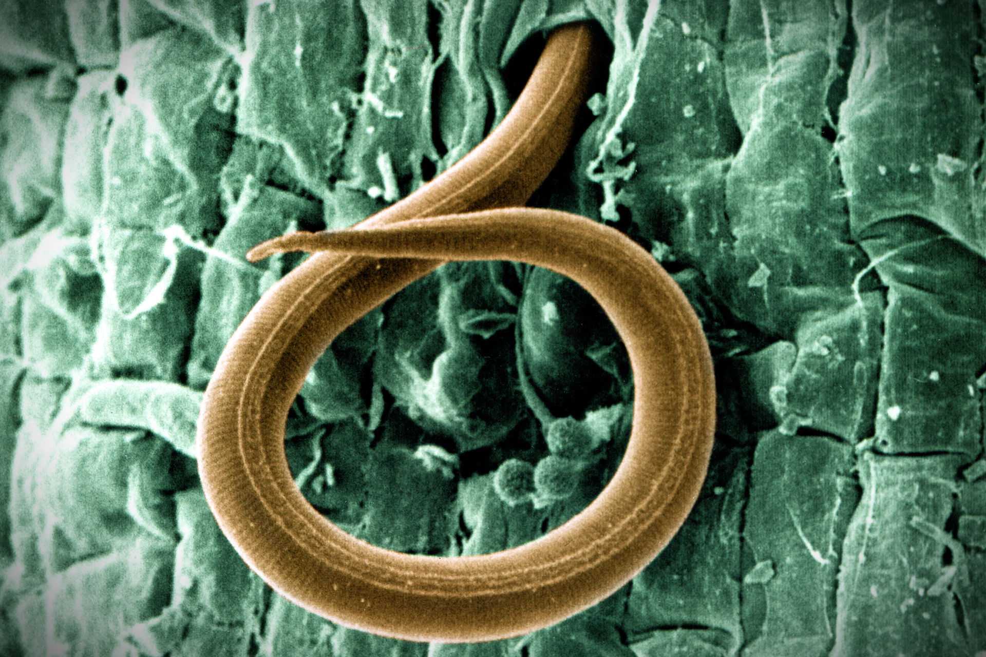 Microscopic view of a nematode exhibiting a distinct coiled shape against a textured background. - Olive Oil Times