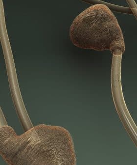 Microscopic image showing sperm cells with distinct shapes and structures against a dark background. - Olive Oil Times