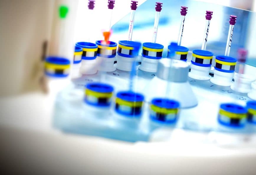 A collection of laboratory sample tubes with colored caps arranged in a circular holder. - Olive Oil Times