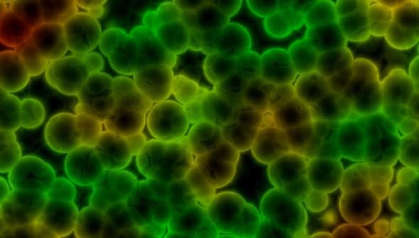 Microscopic image showing clusters of green and yellow bacterial cells on a dark background. - Olive Oil Times